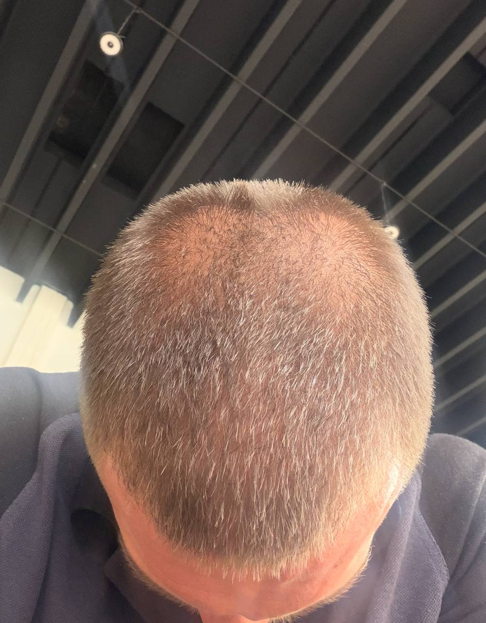 Before — week 0